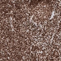 Histone H2AY/macroH2A.1 Antibody (CL5245), Novus Biologicals 25 &mu;L:Antibodies,
