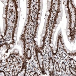 Histone H2AY/macroH2A.1 Antibody (CL5256), Novus Biologicals:Antibodies:Primary
