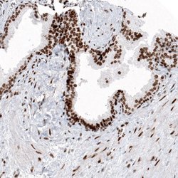 Histone H2AY/macroH2A.1 Antibody (CL5256), Novus Biologicals:Antibodies:Primary
