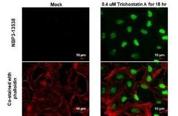 Histone H2B, ac Lys20 Antibody (GT578), Novus Biologicals 100 &mu;g; Unconjugated:Antibodies,