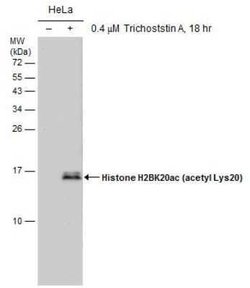 Histone H2B, ac Lys20 Antibody (GT578), Novus Biologicals 100 &mu;g; Unconjugated:Antibodies,