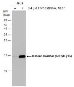 Histone H2a, ac Lys5 Antibody (GT1262), Novus Biologicals 100 &mu;g | Buy Online | Novus Biologicals | Fisher Scientific