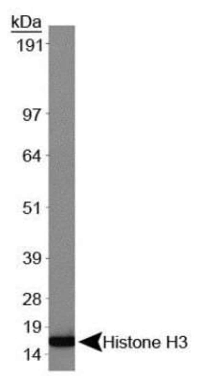 Hemoccult ICT 395065A iFOB: Immunological Fecal Occult Blood