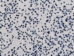 Histone H3, Dimethyl Lys79 Antibody (RM181), Novus Biologicals 100 &mu;g;