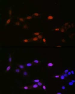 Histone H3 Rabbit anti-Human, Mouse, Rat, Polyclonal, Novus Biologicals 20 &mu;g | Buy Online | Novus Biologicals | Fisher Scientific