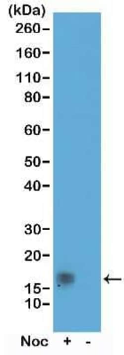Histone H3, p Thr11 Antibody (RM164), Novus Biologicals 100 &mu;g; Unconjugated:Antibodies,