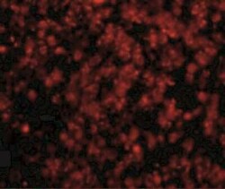 Hormone-sensitive Lipase/HSL Antibody - BSA Free, Novus Biologicals 0.025 mg | Buy Online | Novus Biologicals | Fisher Scientific