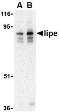Hormone-sensitive Lipase/HSL Antibody - BSA Free, Novus Biologicals 0.025 mg | Buy Online | Novus Biologicals | Fisher Scientific