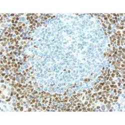 Horse anti-Rabbit IgG ImmPRESS(TM) Secondary Antibody [HRP Polymer], Novus Biologicals 15 mL | Buy Online | Novus Biologicals | Fisher Scientific