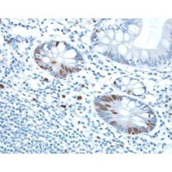 Horse anti-Rabbit IgG ImmPRESS(TM) Secondary Antibody [HRP Polymer], Novus Biologicals 15 mL | Buy Online | Novus Biologicals | Fisher Scientific