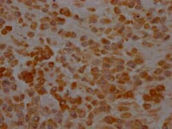 Hsp47 Antibody (10B2), Novus Biologicals 100 &mu;g; Unconjugated:Antibodies,