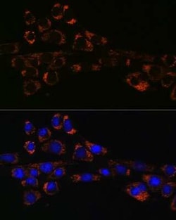 Hsp47 Rabbit anti-Human, Mouse, Clone: 3K3H1, Novus Biologicals 20 &mu;g;