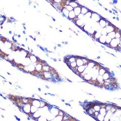 Hsp47 Rabbit anti-Human, Mouse, Clone: 3K3H1, Novus Biologicals 20 &mu;g;