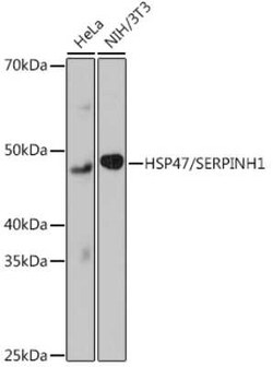 Hsp47 Rabbit anti-Human, Mouse, Clone: 3K3H1, Novus Biologicals 20 &mu;g;