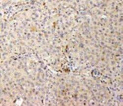 Hsp47 Antibody (M16.10A1), Novus Biologicals:Antibodies:Primary Antibodies