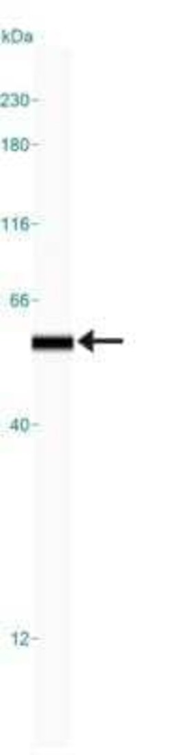 Hsp47 Antibody (M16.10A1), Novus Biologicals:Antibodies:Primary Antibodies