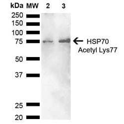 HSP70/HSPA1A, ac Lys77 Antibody, Novus Biologicals 100&mu;L:Antibodies,