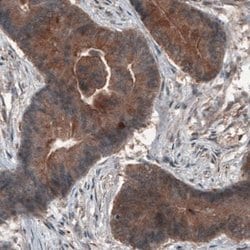 Hsp70 interacting protein HIP Antibody (CL3708), Novus Biologicals 100&mu;L:Antibodies,