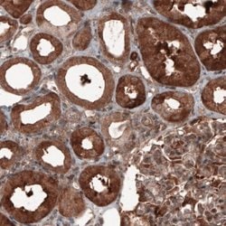 Hsp70 interacting protein HIP Antibody (CL3708), Novus Biologicals 100&mu;L:Antibodies,