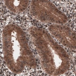 Hsp70 interacting protein HIP Antibody (CL3708), Novus Biologicals 100&mu;L:Antibodies,