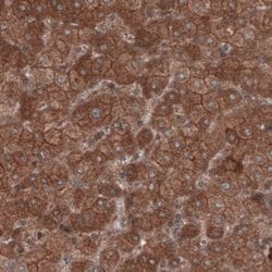Hsp70 interacting protein HIP Antibody (CL3708), Novus Biologicals 100&mu;L:Antibodies,