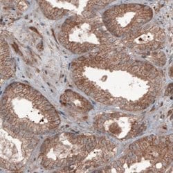 Hsp70 interacting protein HIP Antibody (CL3708), Novus Biologicals 100&mu;L:Antibodies,