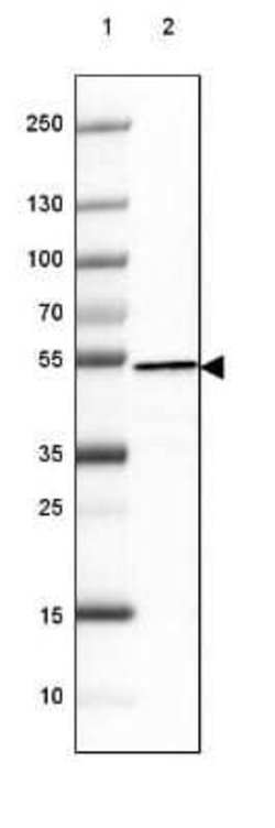 Hsp70 interacting protein HIP Antibody (CL3708), Novus Biologicals 100&mu;L:Antibodies,