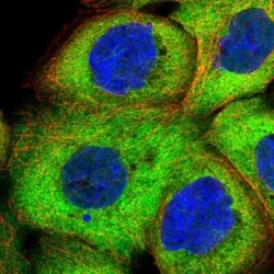 Hsp70 interacting protein HIP Antibody, Novus Biologicals 25 &mu;L, Unconjugated:Antibodies,