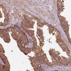 Hsp70 interacting protein HIP Antibody, Novus Biologicals 25 &mu;L, Unconjugated:Antibodies,
