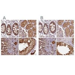 Hsp70 interacting protein HIP Antibody, Novus Biologicals 25 &mu;L, Unconjugated:Antibodies,