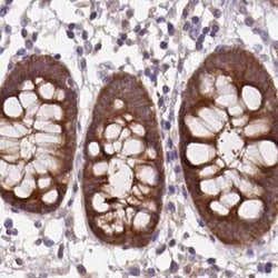 Hsp70 interacting protein HIP Antibody, Novus Biologicals 25 &mu;L, Unconjugated:Antibodies,