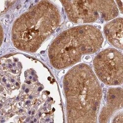 Hsp70 interacting protein HIP Antibody, Novus Biologicals 25 &mu;L, Unconjugated:Antibodies,
