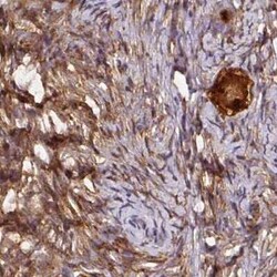 Hsp70 interacting protein HIP Antibody, Novus Biologicals 25 &mu;L, Unconjugated:Antibodies,