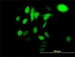 Novus Biologicals HspA1B Antibody (3B7), Novus Biologicals 0.1 mg | Buy Online | Novus Biologicals&trade; | Fisher Scientific