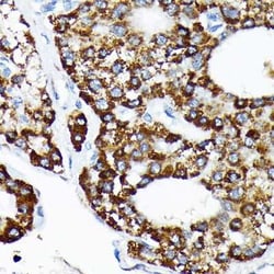 HspA4 Rabbit anti-Human, Mouse, Rat, Clone: 10A9C5, Novus Biologicals:Antibodies:Primary