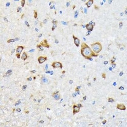 HspA4 Rabbit anti-Human, Mouse, Rat, Clone: 10A9C5, Novus Biologicals:Antibodies:Primary