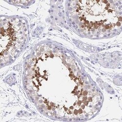 HspA4L Antibody, Novus Biologicals:Antibodies:Primary Antibodies