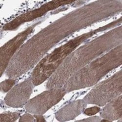 HspB2 Rabbit anti-Human, Polyclonal, Novus Biologicals 25 &mu;g; Unconjugated:Antibodies,