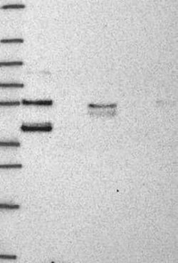 HspBP1 Rabbit anti-Human, Polyclonal, Novus Biologicals 100 &mu;g | Buy Online | Novus Biologicals | Fisher Scientific