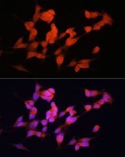 FKBP12.6 Rabbit anti-Human, Mouse, Rat, Polyclonal, Novus Biologicals:Antibodies:Primary
