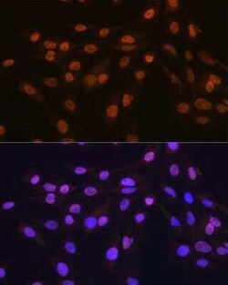 HuR/ELAVL1 Rabbit anti-Human, Mouse, Rat, Clone: 9Q6L3, Novus Biologicals 20 &mu;g | Buy Online | Bio-Techne | Fisher Scientific