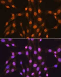 HuR/ELAVL1 Rabbit anti-Human, Mouse, Rat, Clone: 9Q6L3, Novus Biologicals 20 &mu;g | Buy Online | Bio-Techne | Fisher Scientific