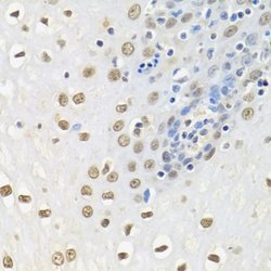 HMGN1/HMG14 Rabbit anti-Human, Mouse, Polyclonal, Novus Biologicals:Antibodies:Primary