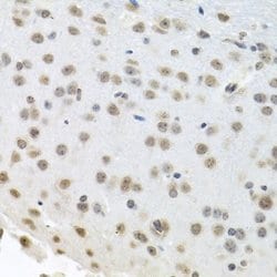 ErbB2/Her2 Rabbit anti-Human, Mouse, Rat, Polyclonal, Novus Biologicals:Antibodies:Primary