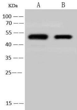 Human Coronavirus Nucleocapsid Protein Antibody, Novus Biologicals:Antibodies:Primary