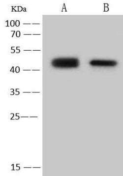 Human Coronavirus Nucleocapsid Protein Antibody, Novus Biologicals:Antibodies:Primary