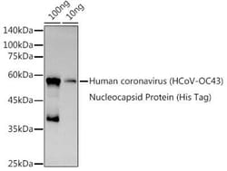 Human Coronavirus Nucleocapsid Protein Rabbit anti-HCoV-OC43, Polyclonal,