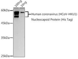 Human Coronavirus Nucleocapsid Protein Rabbit anti-HCoV-HKU1, Polyclonal, Novus Biologicals 100 &mu;g | Buy Online | Novus Biologicals | Fisher Scientific