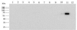 Human Coronavirus Spike Protein Mouse anti-HCoV-HKU1, Clone: 5, Novus Biologicals