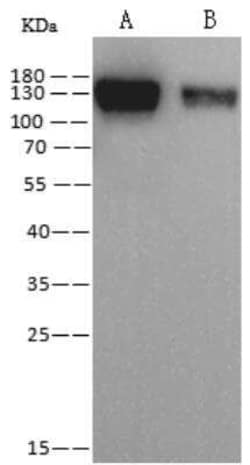 Human Coronavirus Spike Protein Antibody (07), Novus Biologicals 50 &mu;g;